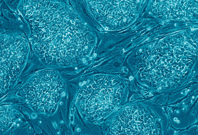 Human_embryonic_stem_cells